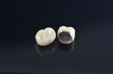 Trả lời: Nên bọc răng sứ kim loại hay titan? Loại nào an toàn và bền hơn?
Trong số những giải pháp...