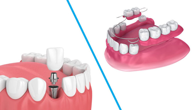 Nha khoa Hai Duong giai phap cham soc rang mieng toan dien cho nu cuoi khoe manh
Xu huong cham soc...