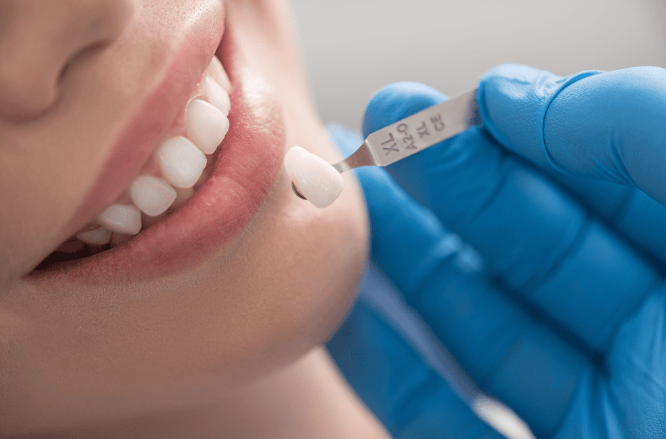 Phong kham nha khoa bi quyet lua chon dia chi dung va an toan Cham soc rang mieng khong chỉ giúp bạn...