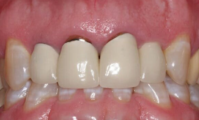 Nha khoa Sing Nam Dinh dia chi uy tin cho nu cuoi khoe dep 
Trong nhung nam tro lai gan day thi nhu...