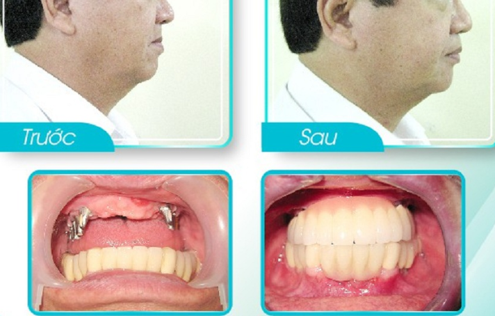 Nha khoa Thai Binh dia chi cham soc rang mieng chat luong va uy tin 
Nhu cau tim kiem mot dia chi...