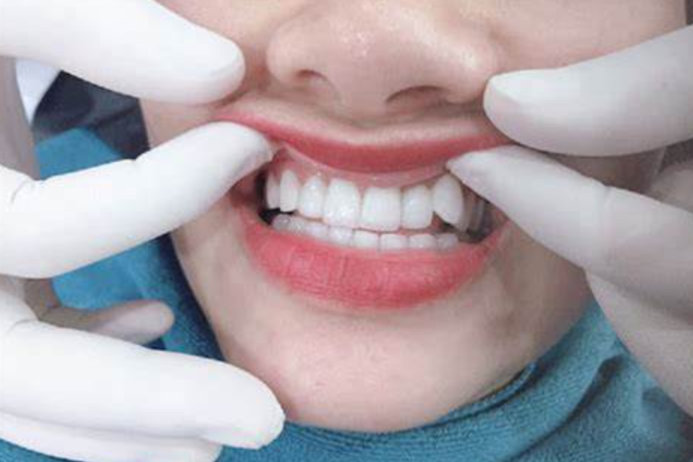 Tìm hiểu Nha khoa Nam Định uy tín và các ưu đãi đặc biệt
Trong những năm gần đây, nhu cầu chăm sóc...