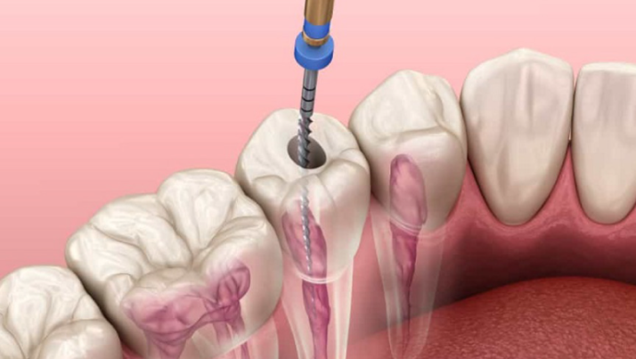 Nha khoa Sing Nam Dinh lua chon thong minh cho nu cuoi khoe dep 
Trong xa hoi hien dai rang mieng...