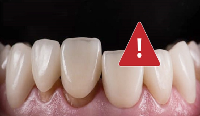 Nha khoa Nam Dinh dia chi tin cay cho nu cuoi khoe dep 
Nu cuoi sang ham rang chac khoe khong chi...