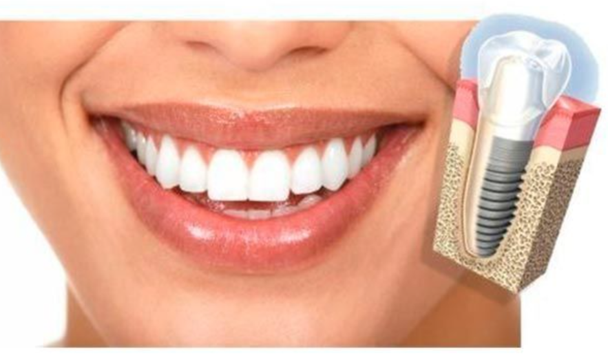 Kinh nghiệm chọn nha khoa Nam Định chất lượng cao
Sức khỏe răng miệng là yếu tố không thể xem nhẹ...