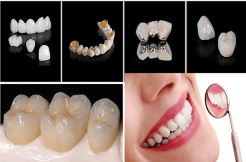 Boc rang su giai phap nha khoa hien dai cho nu cuoi hoan hao 
Mot nu cuoi tuoi tan khong chi tao an...