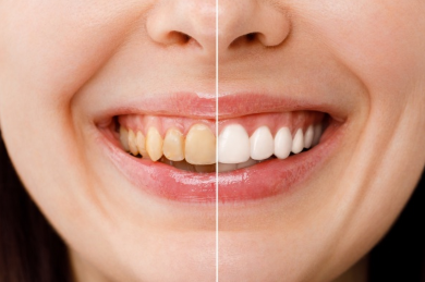 Nha khoa Sing diem den dang tin cay cho nhu cau cham soc rang Neu ban dang tim kiem mot dia chi uy...