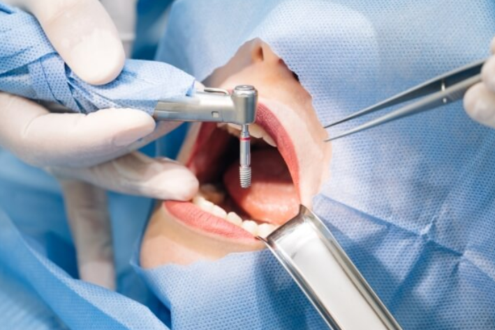 Nha khoa Nam Dinh: Cung tim hieu nha khoa Sing uy tin
Giua rat nhieu co so nha khoa moc len tai dia...