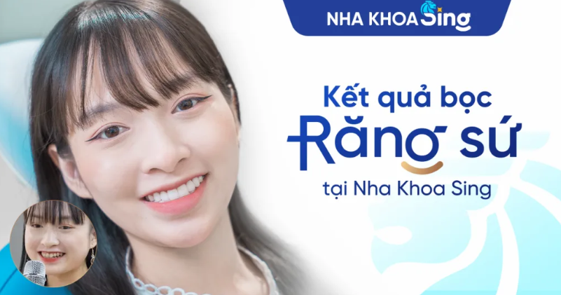 9 Trường hợp nên và không nên bọc răng sứ
Bọc răng sứ không còn xa lạ với nhiều người khi muốn cải...
