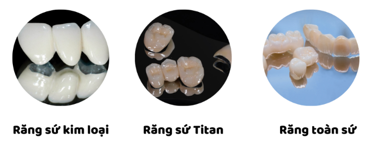 Nha khoa Nam Định uy tín ở đâu? Tổng hợp thông tin cơ bản nhất
Nhu cầu chăm sóc răng miệng ngày...