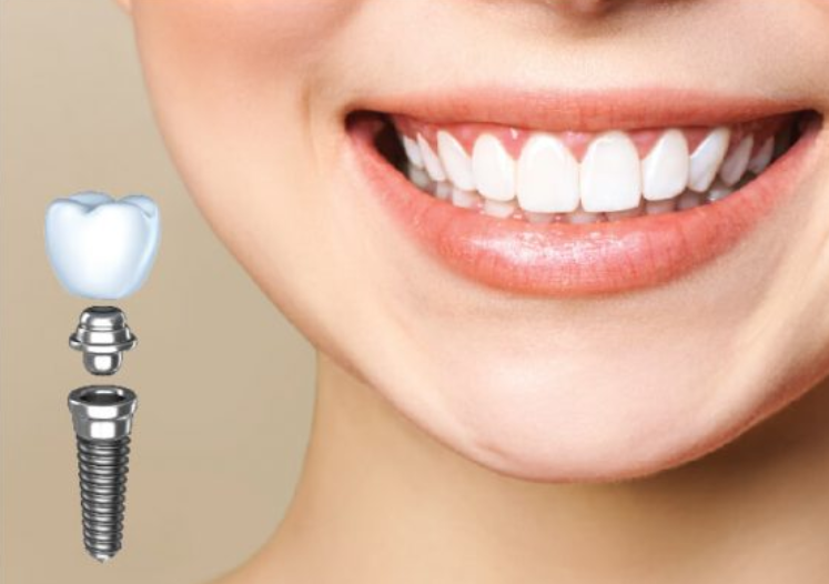 Tại sao nha khoa Hải Dương luôn được khách hàng tin tưởng thăm khám?
Sức khỏe răng miệng là yếu tố...