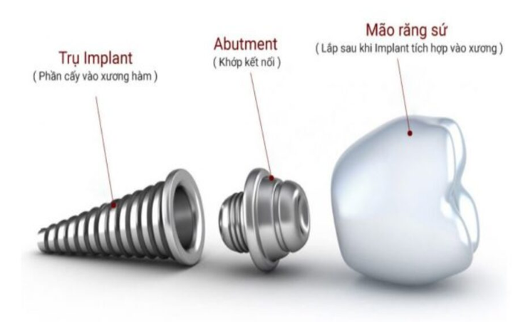 Trồng răng implant nguy hiểm không? Giải đáp thắc mắc
Trồng răng implant là một trong những giải...