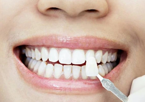 Nha khoa Hai Duong hanh trinh chi mai thay doi nu cuoi tai Sing
Tim kiem mot nha khoa o hai duong...